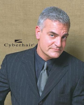   solutions mens gallery cyberhair 02 CyberHair Before and After Photo 01